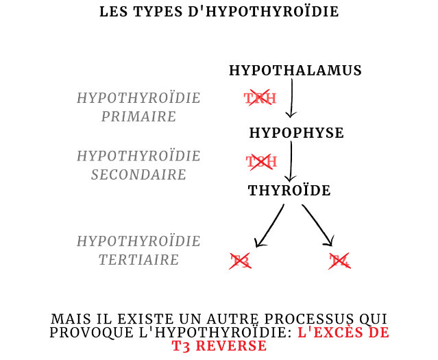 Les types d’hypothyroïdie