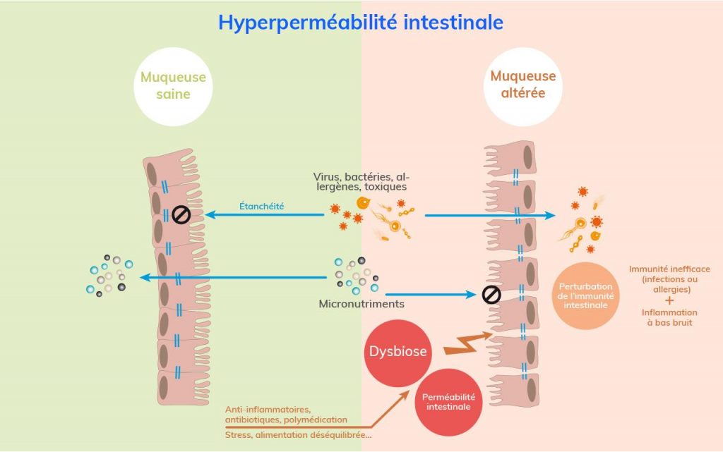 Conséquences de l’hyperperméabilité intestinale sur l’immunité